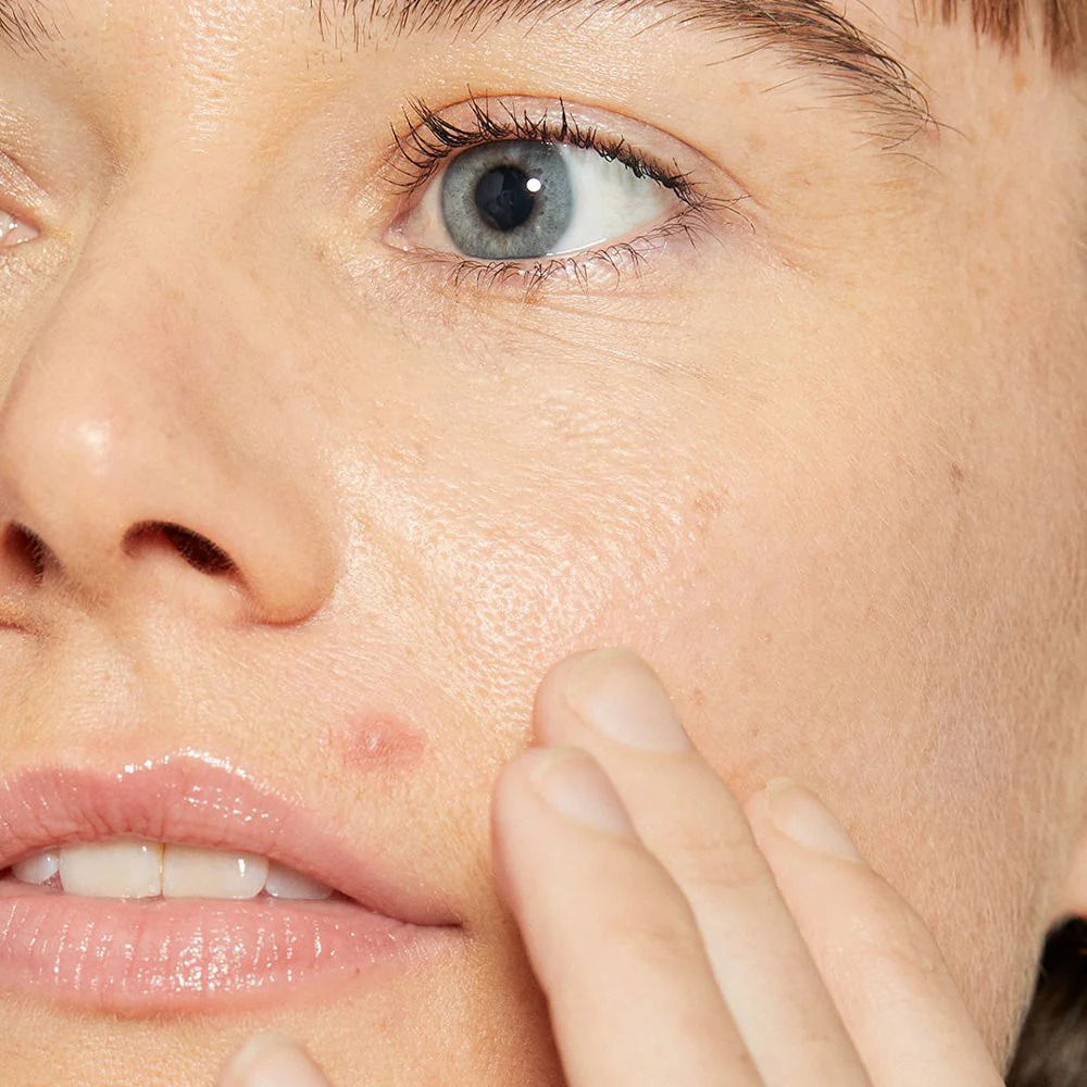 Deep Breakout Liquid Patch - Image 3